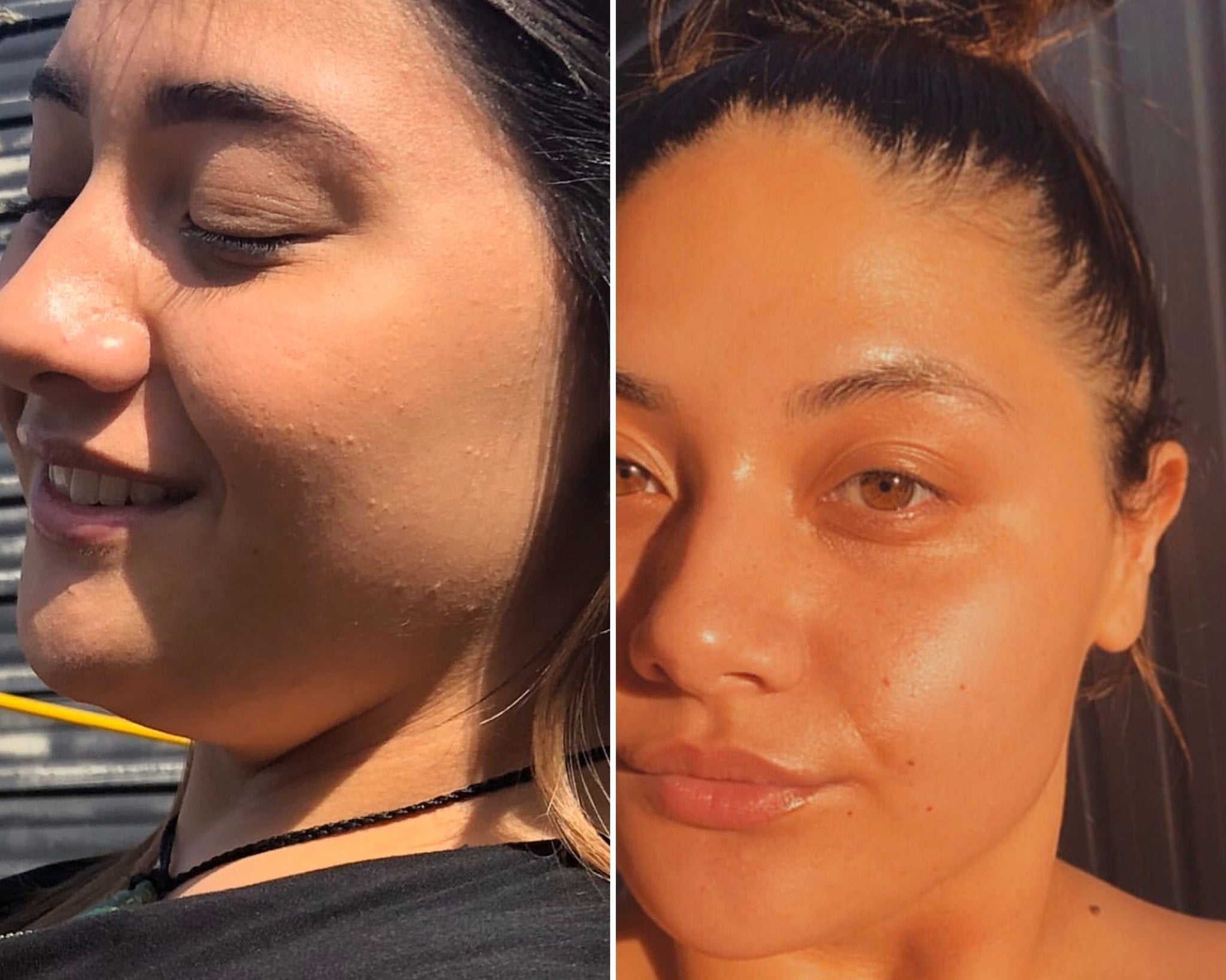 Texture issues B&A - Supple Skin Co