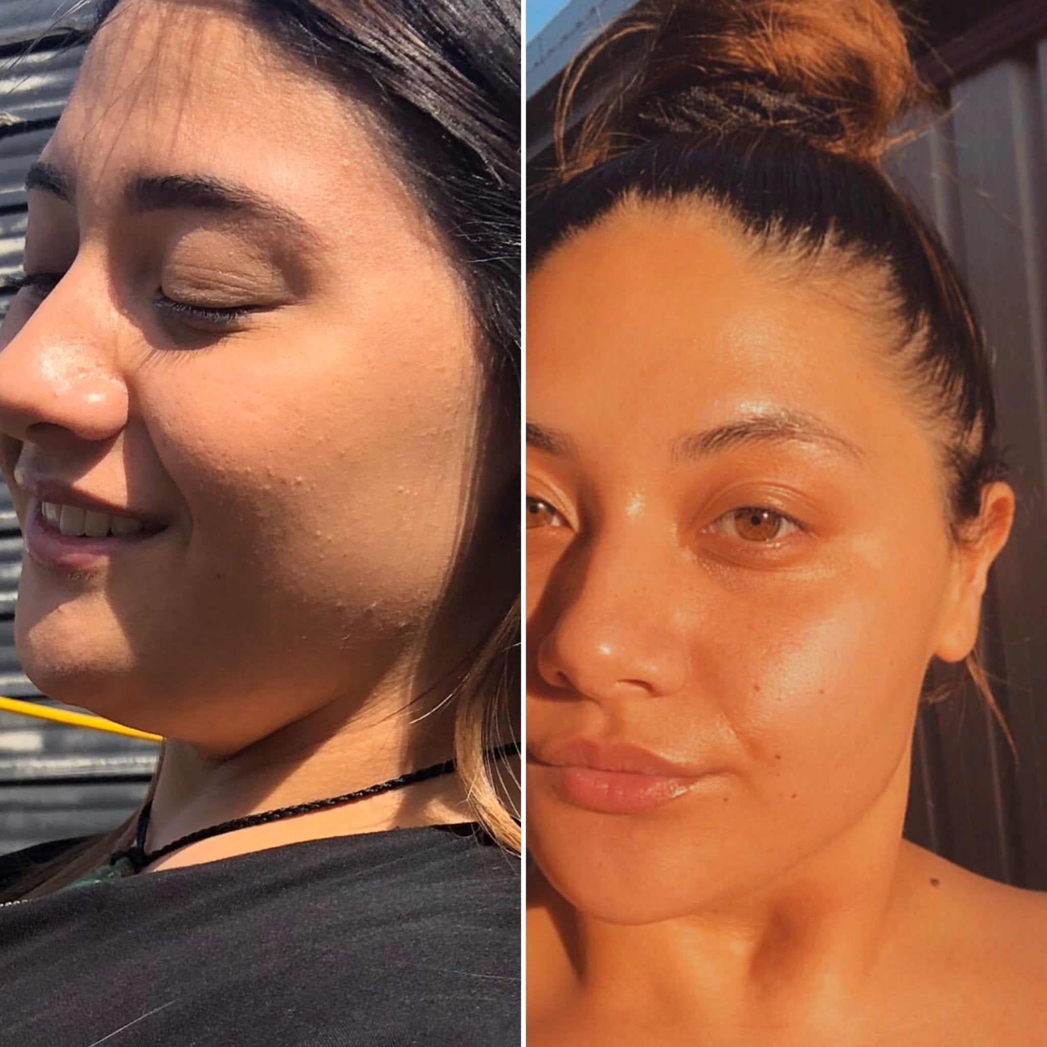 Texture issues B&A - Supple Skin Co